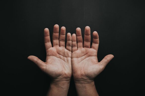 A pair of upturned hands displayed against a dark background, showcasing skin texture.